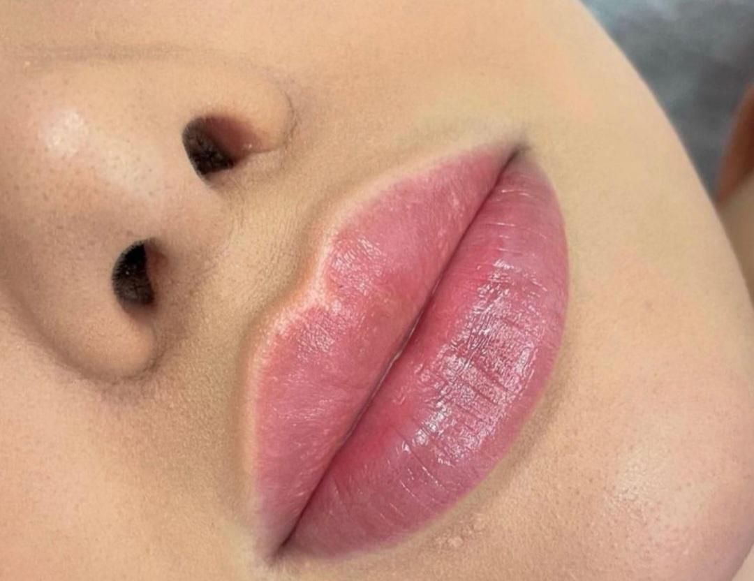 تخفیف تزریق ژل،ژل لب روسی تخصصی،بوتاکس|خدمات آرایشگری و زیبایی|اسلام‌شهر, شهرک انبیا|دیوار