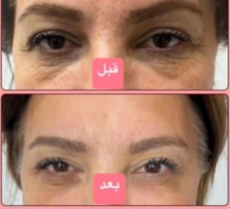 آفر فر مو، پروتئینه،لیفت و لمینت مژه ابرو،مژه موقت|خدمات آرایشگری و زیبایی|تهران, بهار|دیوار