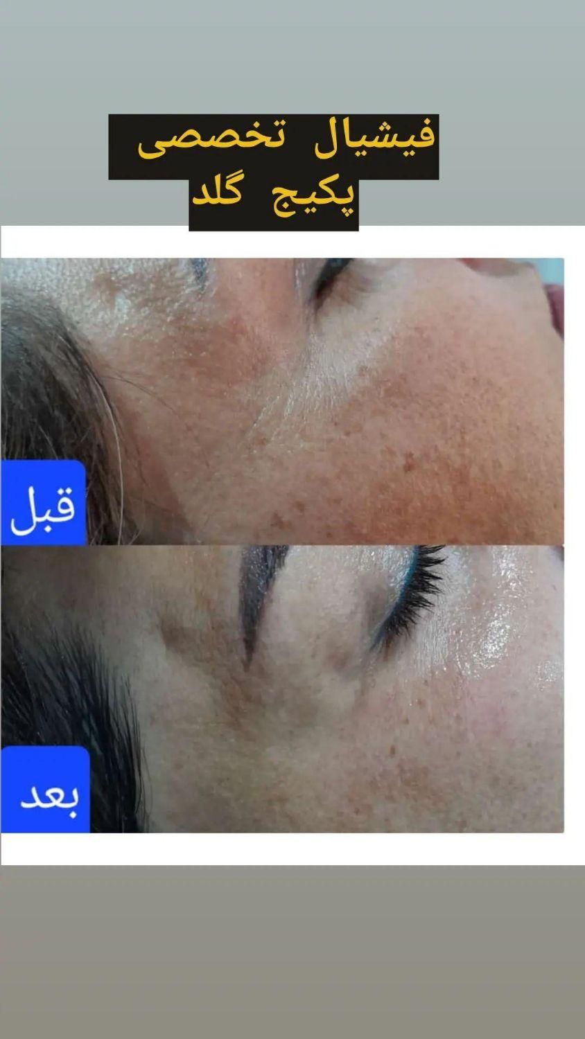 فیشیال تخصصی بانوان و آقایان و آموزش|خدمات آرایشگری و زیبایی|شیراز, تل حسین‌آباد|دیوار