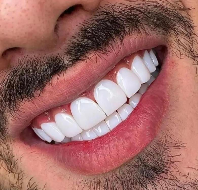 کامپوزیت دندان|خدمات آرایشگری و زیبایی|اسلام‌شهر, شهرک مهدیه|دیوار