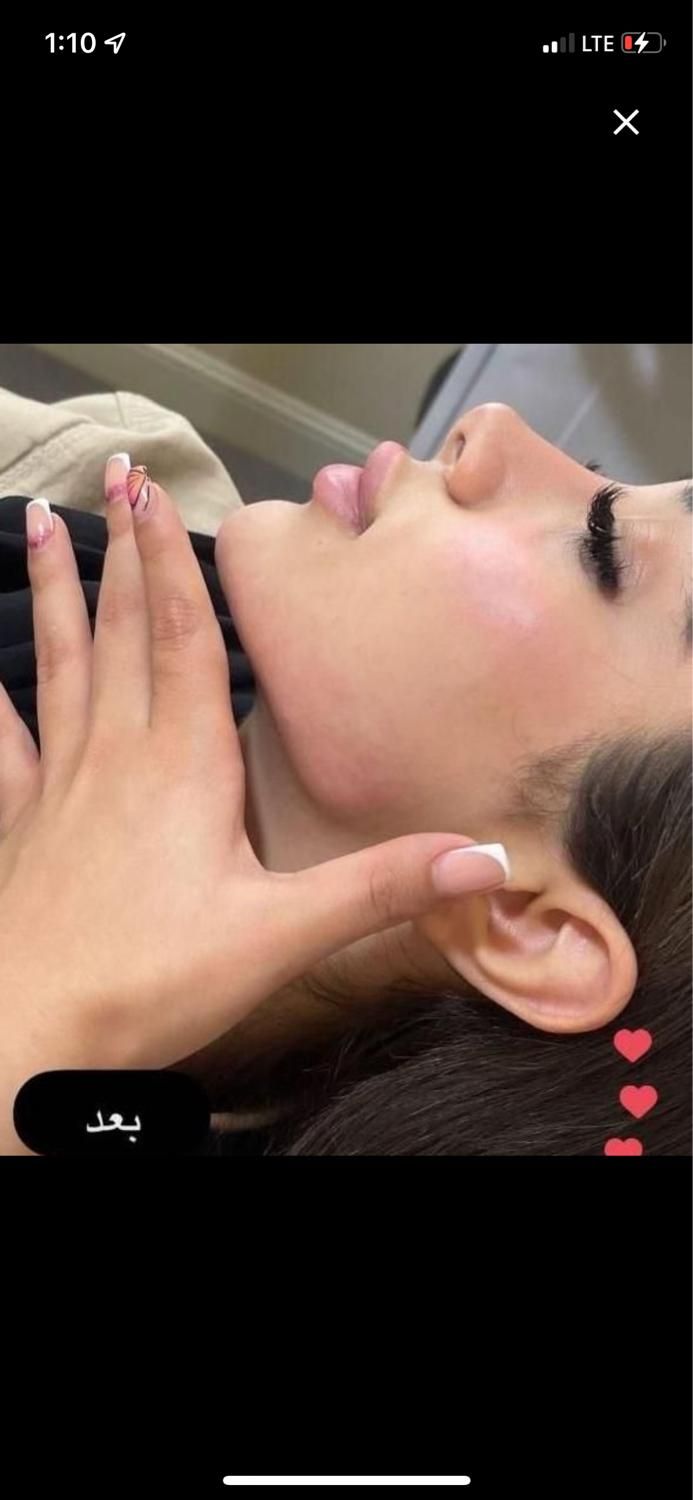 لیفت صورت/تزریق ژل/لیزر مو/جراحی پلک در کلینیک|خدمات آرایشگری و زیبایی|تهران, طرشت|دیوار