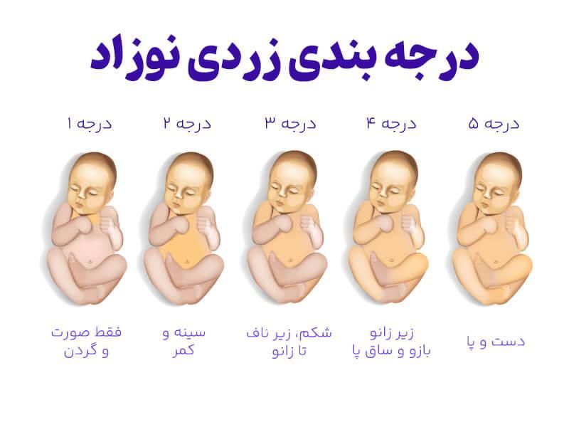 تجهیزات پزشکی درمنزل(اجاره دستگاه زردی نوزاد)|خدمات آرایشگری و زیبایی|تهران, اتابک|دیوار