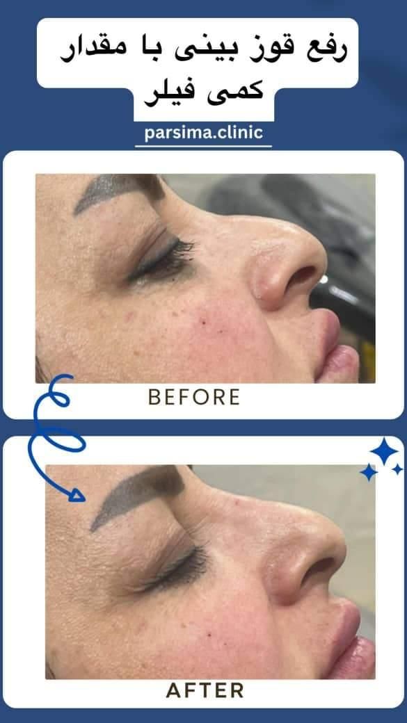 تخفیفات ویژه/اگزوزوم/مزو ژل/لیفتینگ/فشیال تخصصی|خدمات آرایشگری و زیبایی|شیراز, وحدت|دیوار