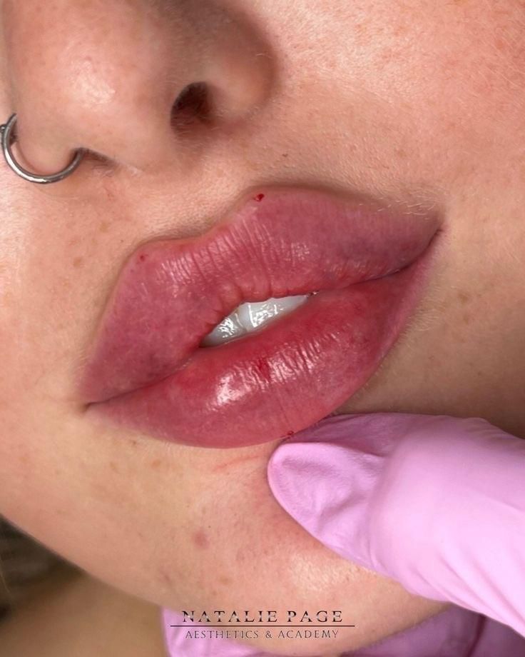 مادلینگ صورت،بوتاکس،لب روسی بانوان و آقایان|خدمات آرایشگری و زیبایی|تهران, توحید|دیوار