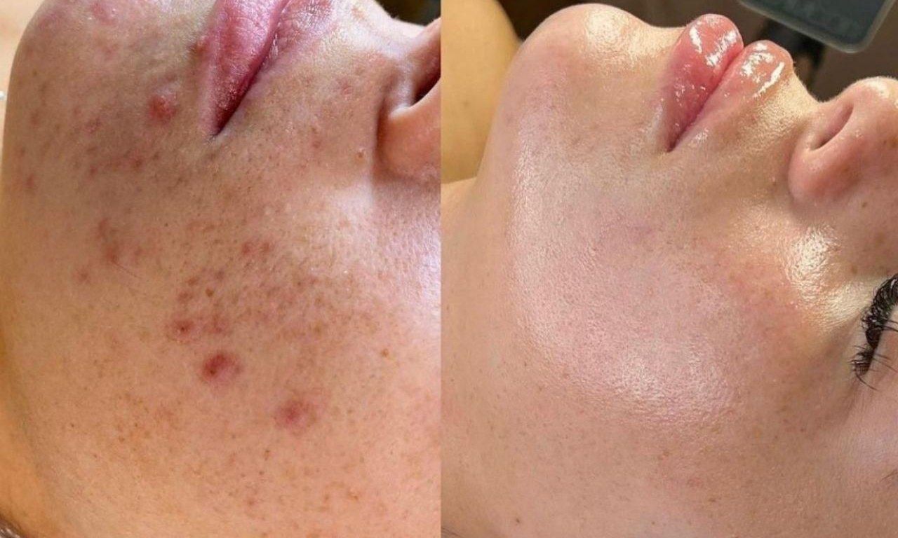 پیراپزشک طب سنتی متخصص پوست|خدمات آرایشگری و زیبایی|رشت, رودباری|دیوار