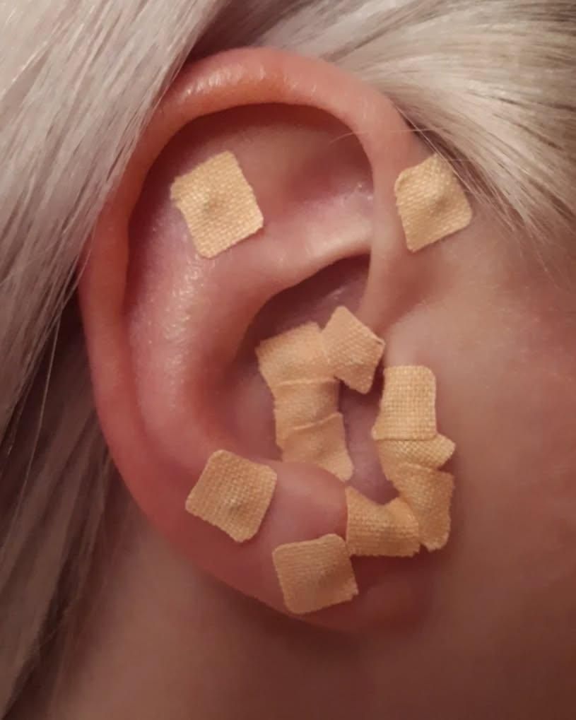 امبدینگ موکساتراپی حجامت طب سوزنی بادکش فصد|خدمات آرایشگری و زیبایی|اصفهان, شهریار|دیوار