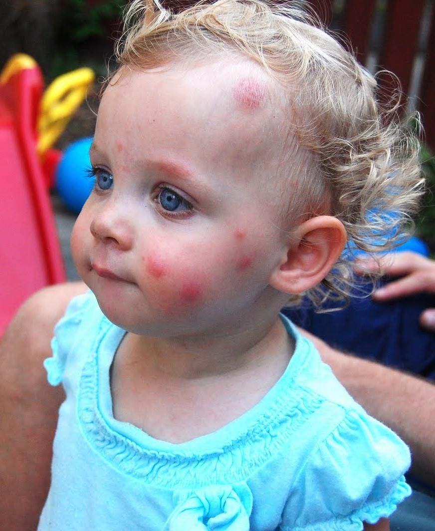 سمپاشی و موریانه زدایی تضمینی امیدیه|خدمات نظافت|امیدیه, |دیوار