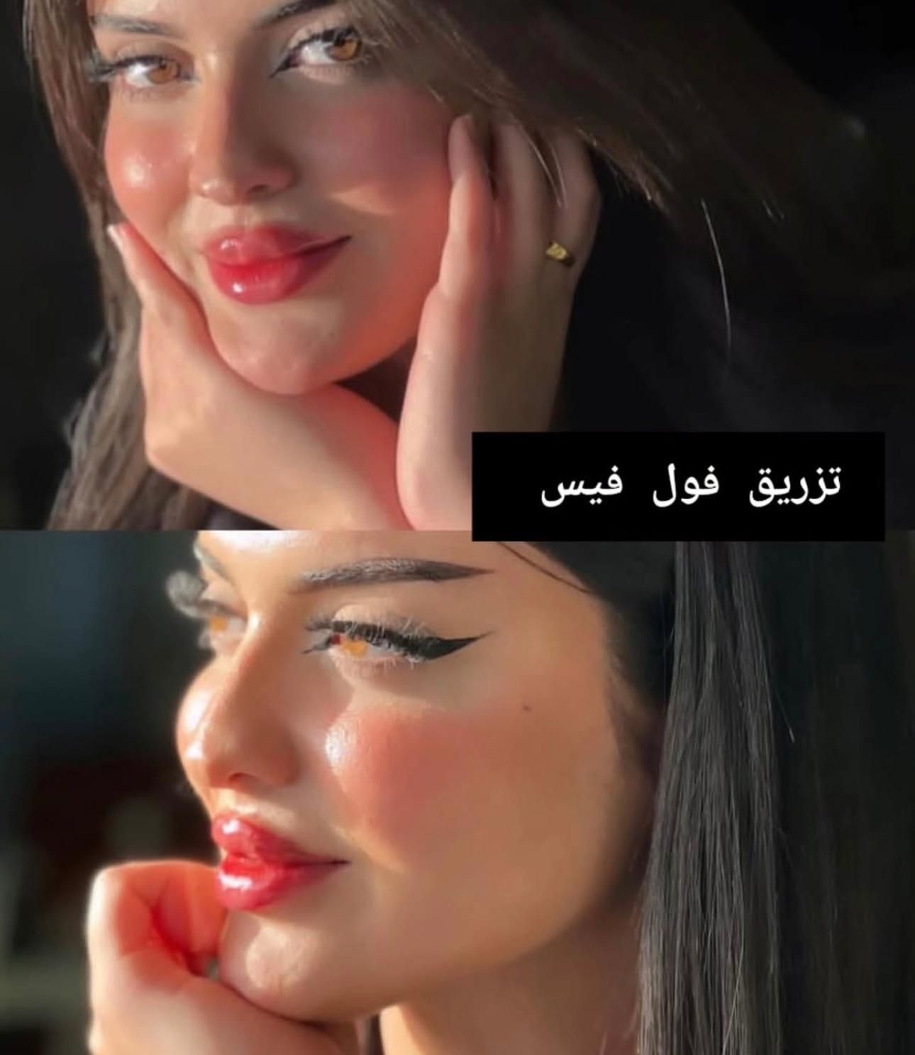 ساکشن شکم و‌پهلو بلفارو و جراحی|خدمات آرایشگری و زیبایی|مشهد, هفت تیر (حافظ)|دیوار