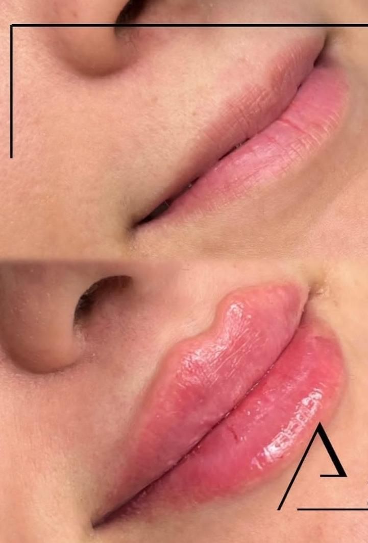 جشنواره تخفیف ویژه لیزر،ژل،بوتاکس،کلیه خدمات پزشکی|خدمات آرایشگری و زیبایی|ساری, |دیوار