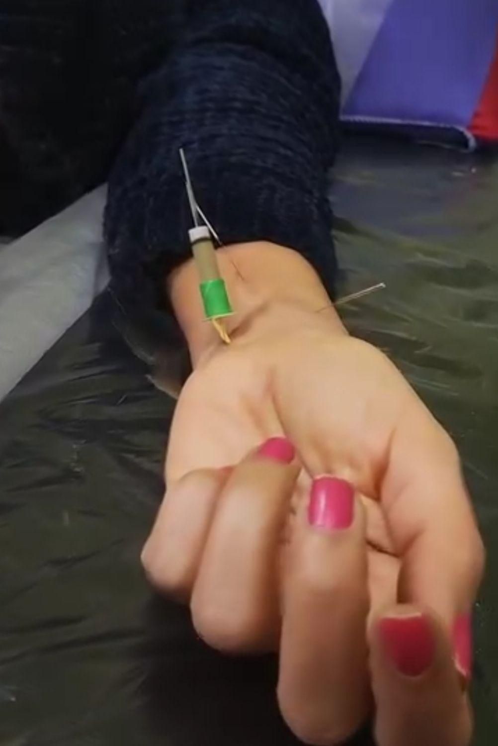 امبدینگ موکساتراپی حجامت طب سوزنی بادکش فصد زگیل|خدمات آرایشگری و زیبایی|اصفهان, مسجد مصلی|دیوار