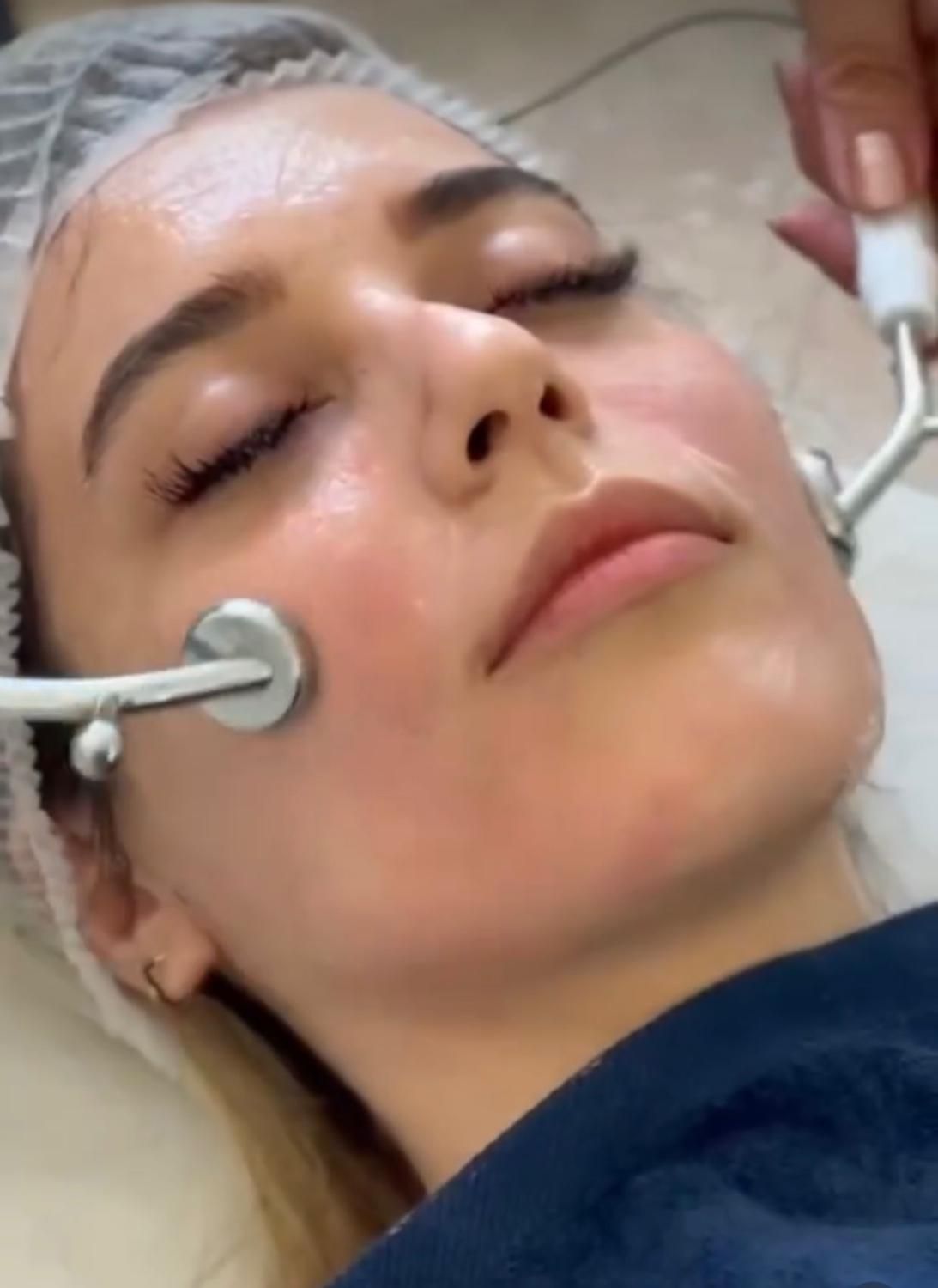 فیشیال ،پلاژن تراپی ، کربوکسی تراپی‌ ، آبرسانی|خدمات آرایشگری و زیبایی|تهران, شهرک غرب|دیوار