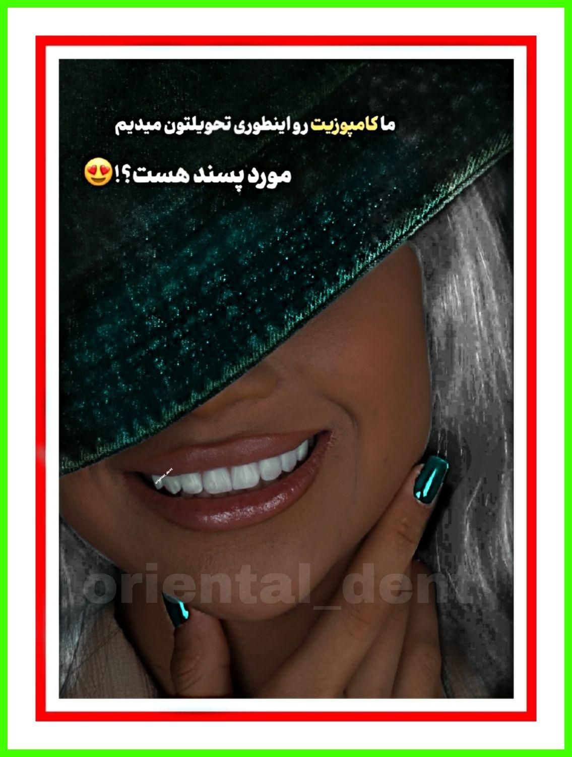 کامپوزیت دندان/دندانپزشکی/ترمیم/عصبکشی/لمینیت|خدمات آرایشگری و زیبایی|تهران, تهرانپارس شرقی|دیوار