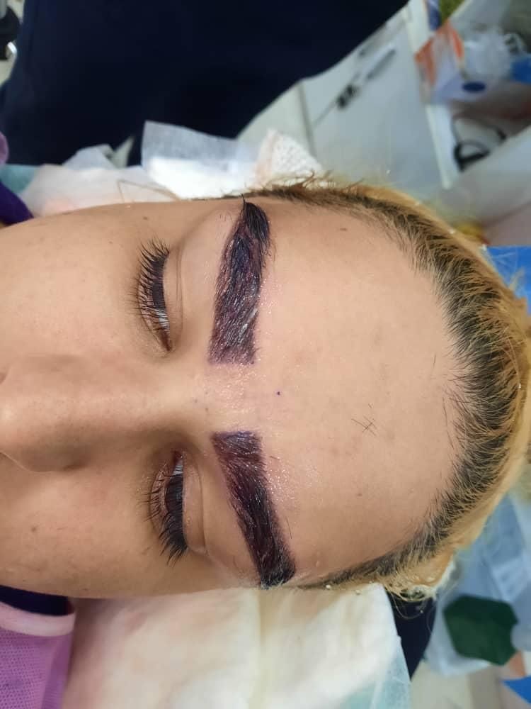 تزریق ژل و بوتاکس در تمام ایام حتی روزهای تعطیل|خدمات آرایشگری و زیبایی|فردیس, |دیوار