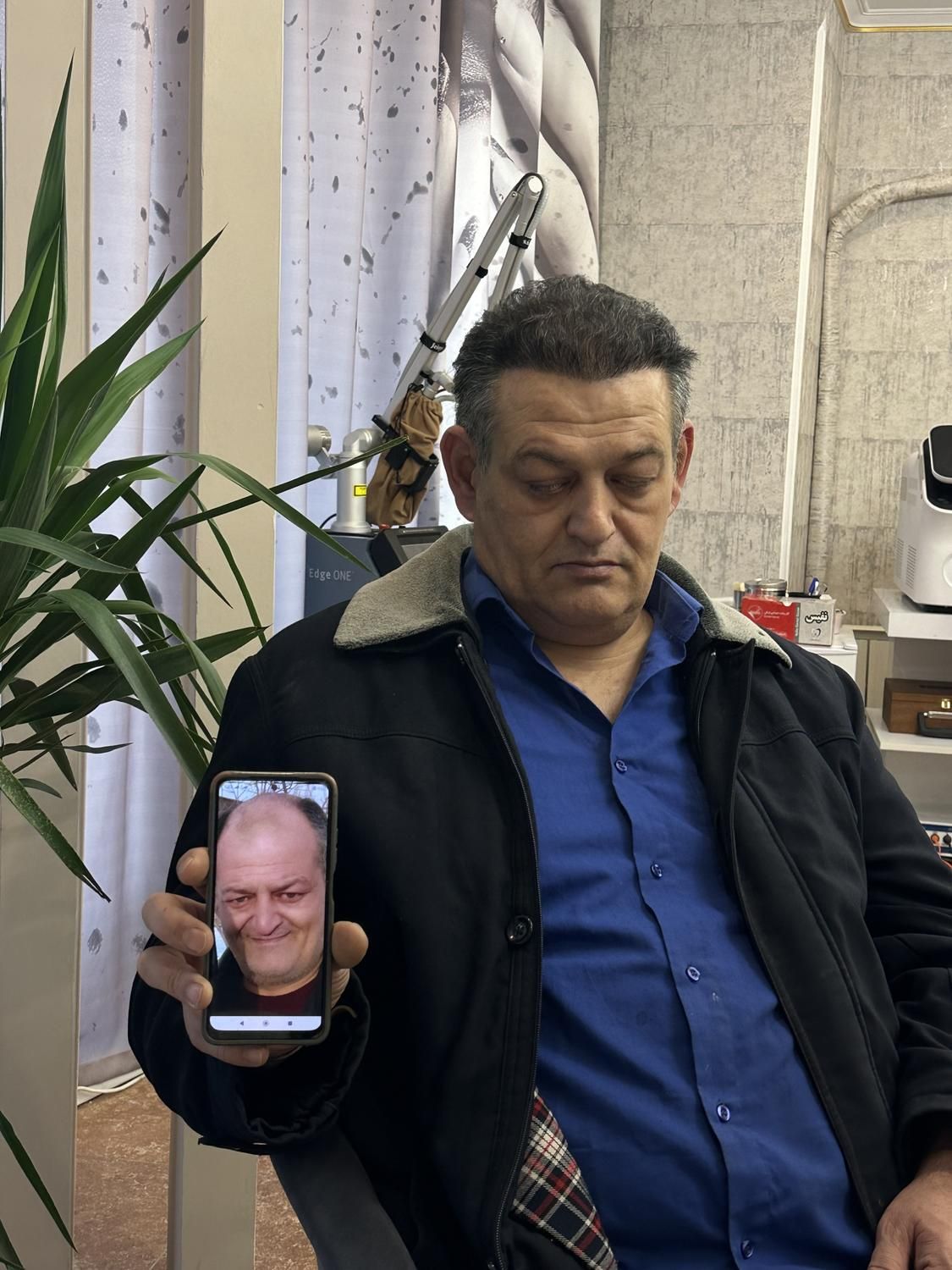 کاشت مو ابرو ریش کلینیک تخصصی اکسیر|خدمات آرایشگری و زیبایی|تبریز, |دیوار