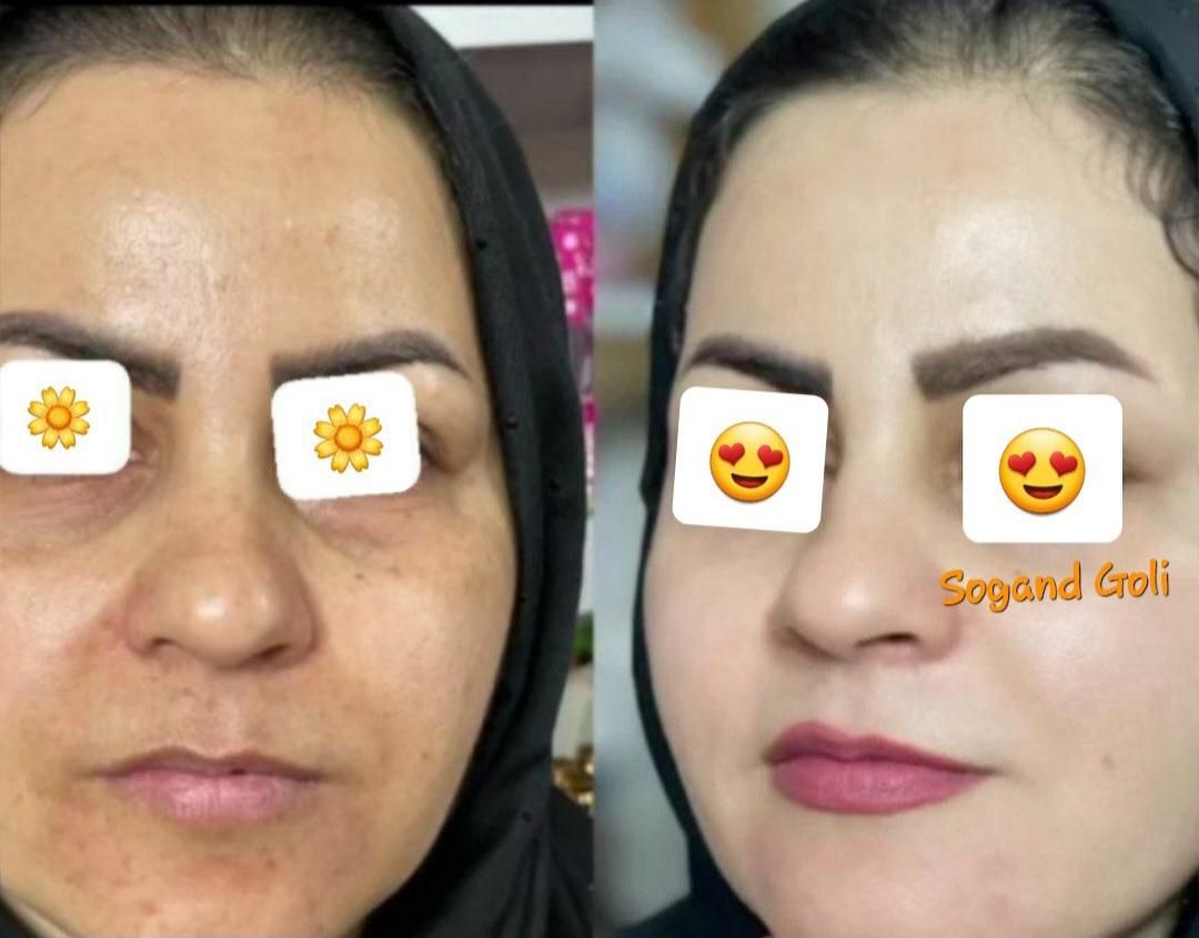 کرم دست ساز کاملا طبیعی و گیاهی سوگندگلی|آرایشی، بهداشتی، درمانی|علی‌آباد کتول, |دیوار