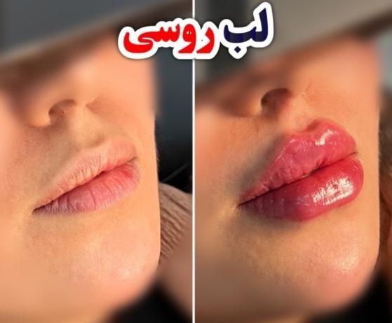 آموزش و خدمات تخصصی فیلر بادی(مطب)|خدمات آموزشی|کرج, جهان‌شهر|دیوار