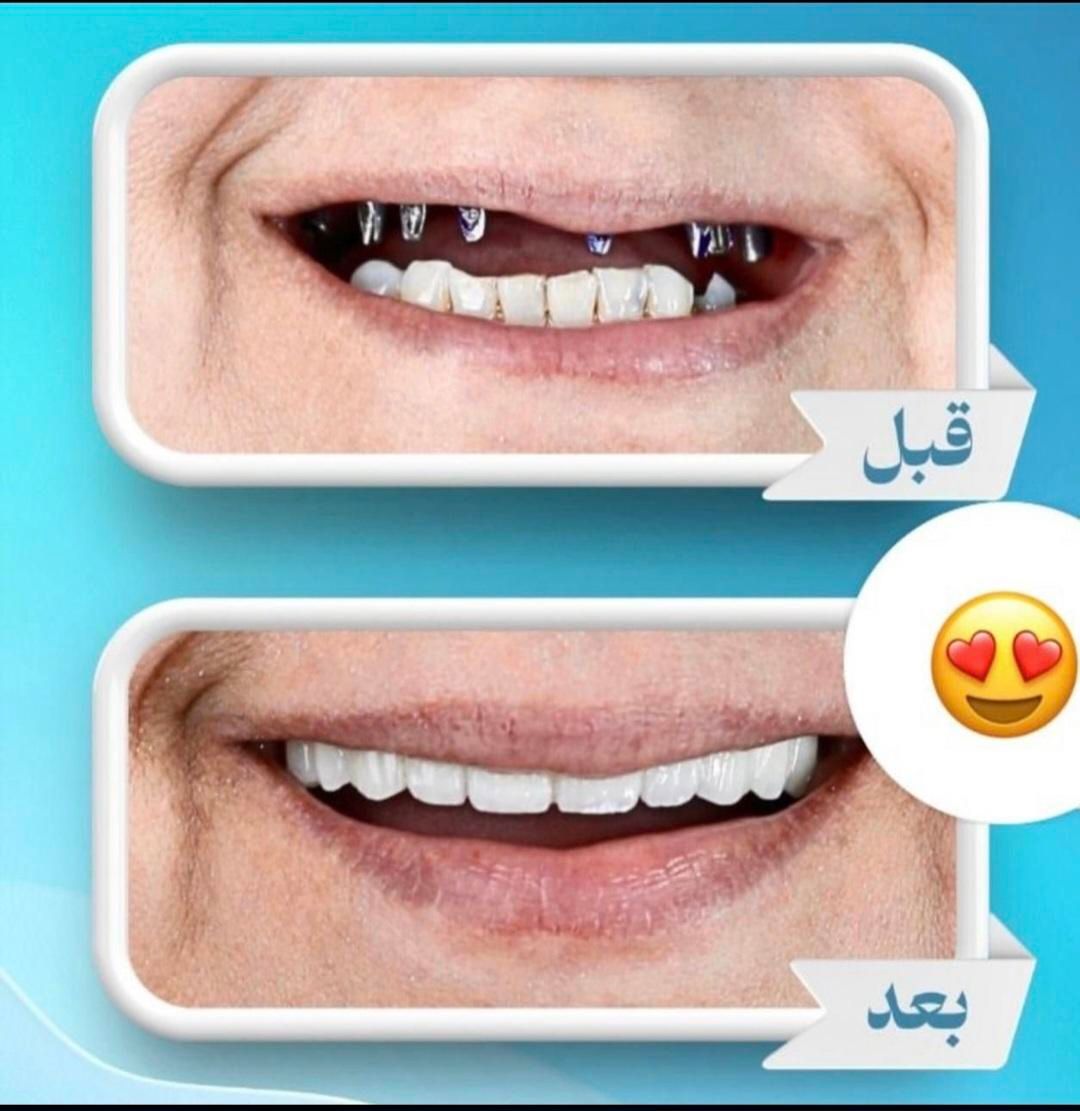 کلینیک تخصصی دندانپزشکی و ایمپلنت  در سیرجان|خدمات آرایشگری و زیبایی|سیرجان, |دیوار