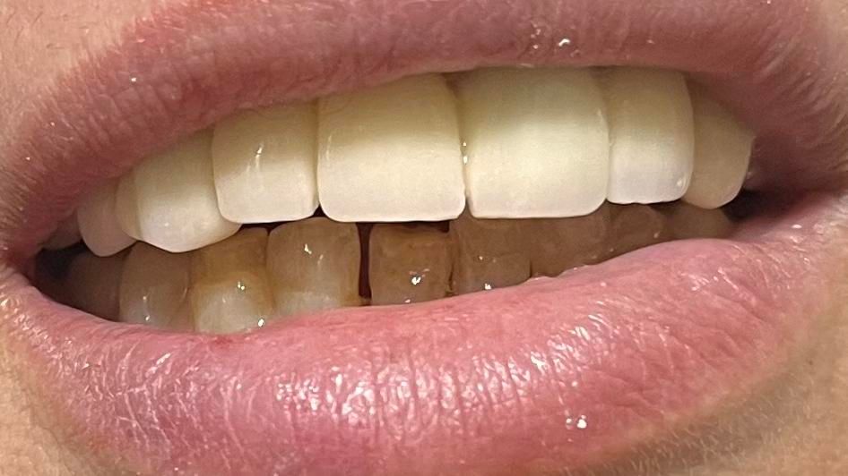 دندانسازی مددی با بیش از ۴۰ سال سابقه درخشان|خدمات آرایشگری و زیبایی|تبریز, |دیوار