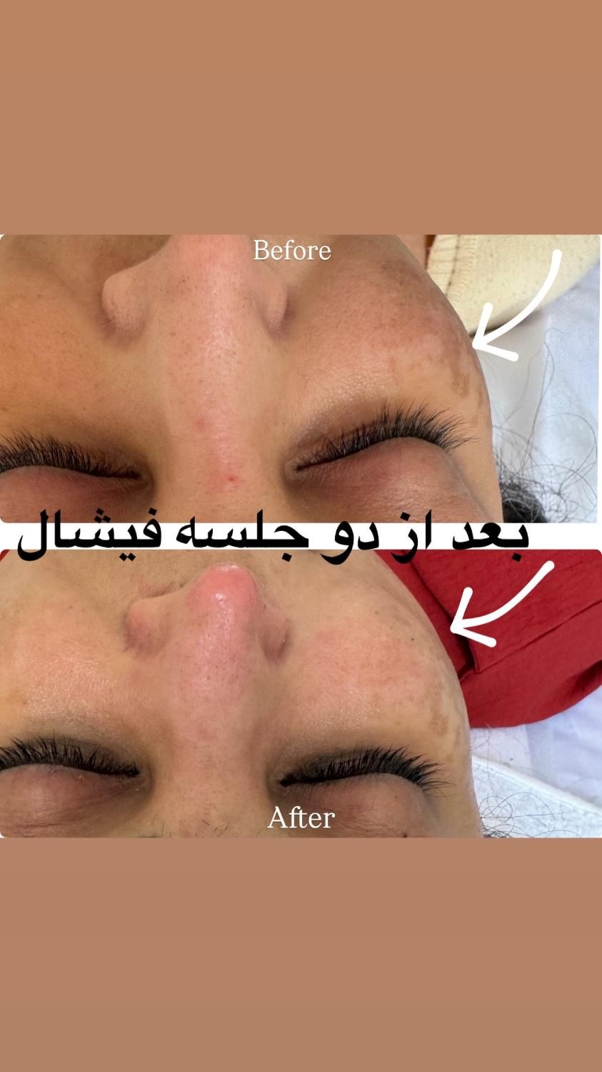 پاکسازی و فیشال تخصصی مشاوره رایگان|خدمات آرایشگری و زیبایی|تهران, حکمت|دیوار