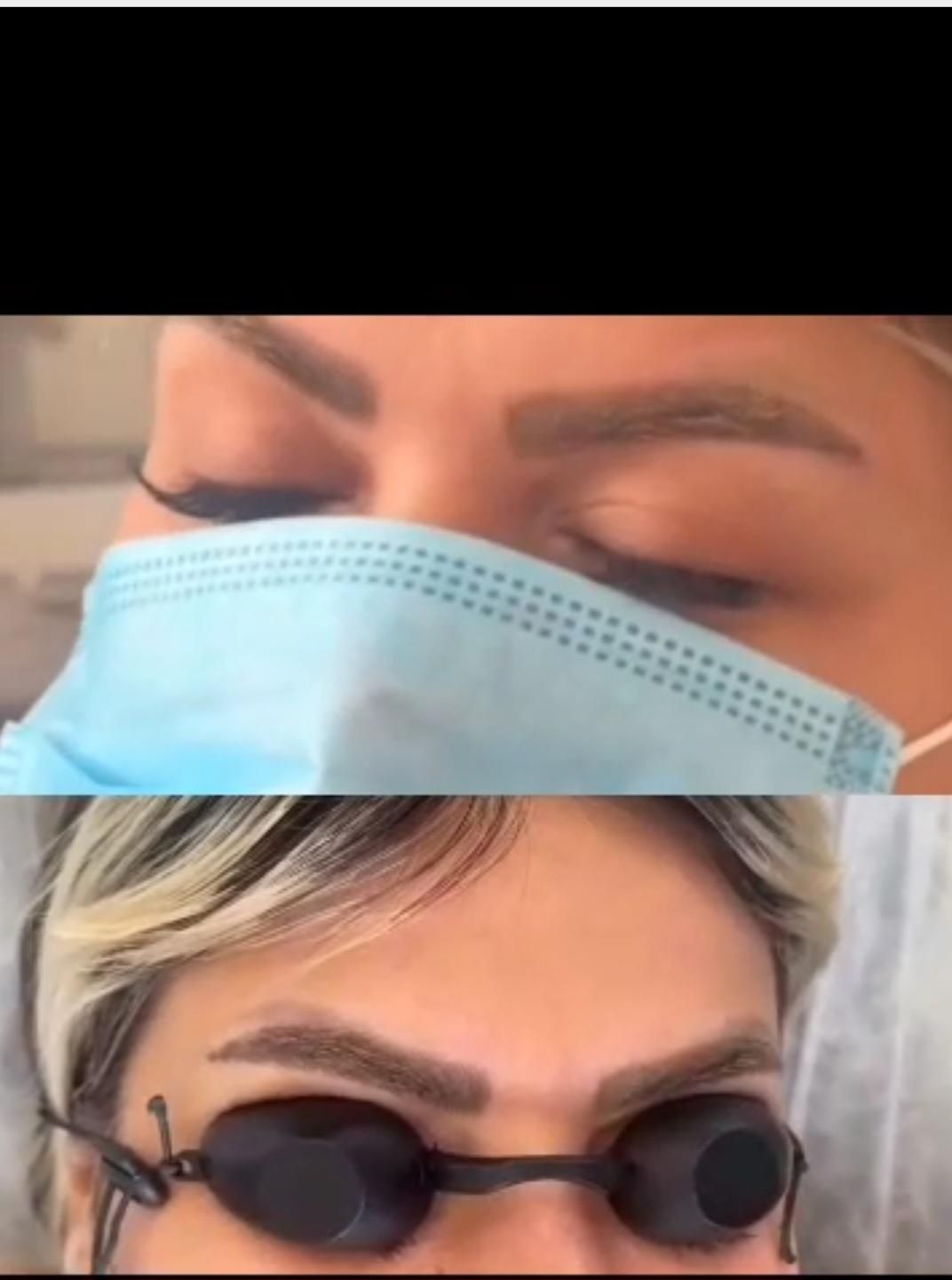 ریمو تتو و کربن تراپی|خدمات آرایشگری و زیبایی|سنندج, |دیوار