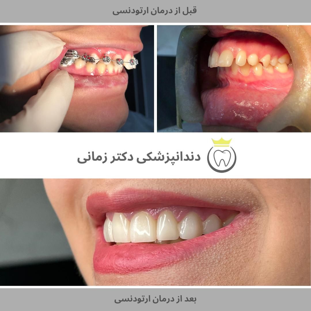 ارتودنسی نامرئی به روش دیجیتالی|خدمات آرایشگری و زیبایی|تهران, امیریه|دیوار