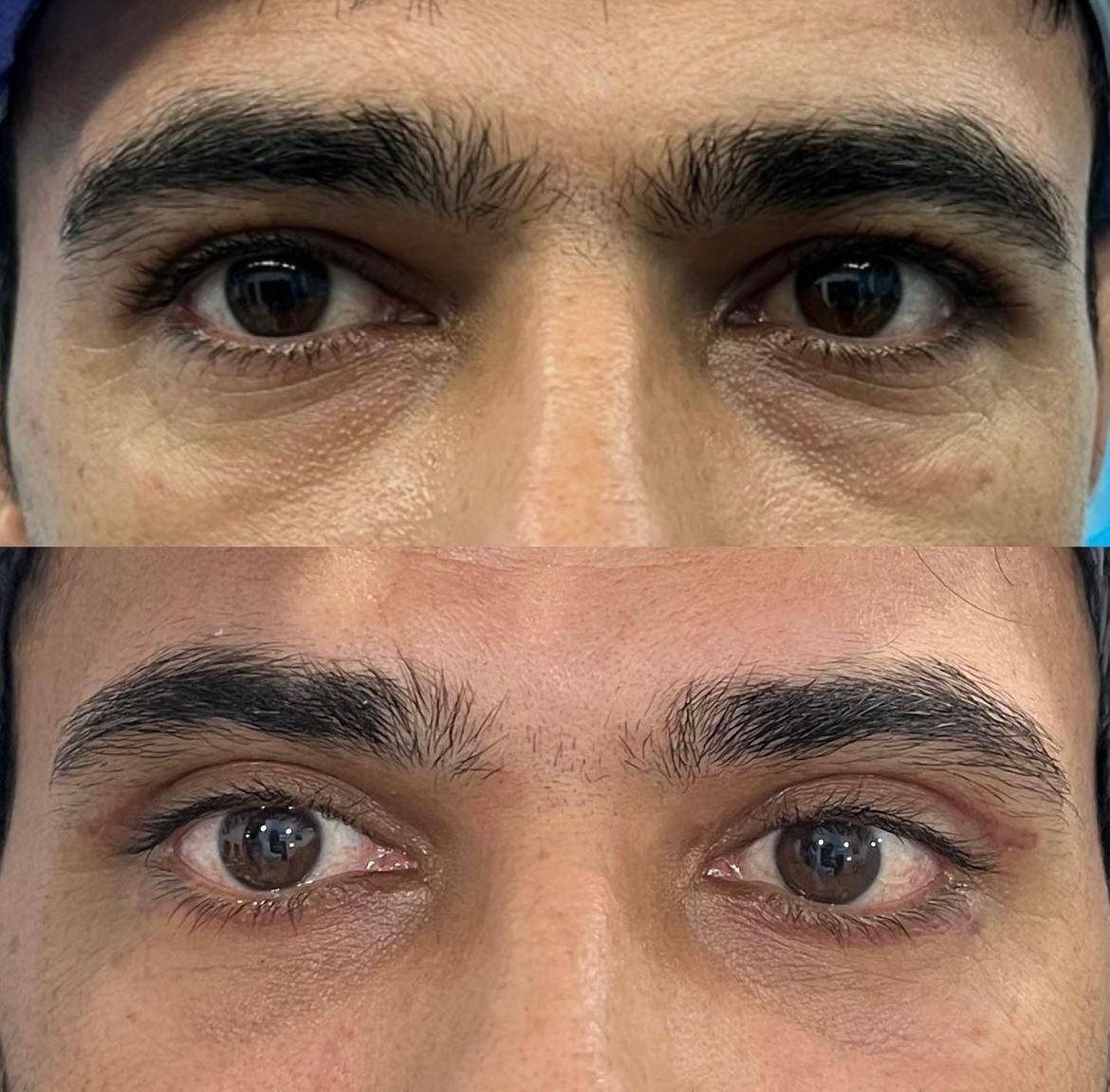 جراحی بینی ابدومینوپلاستی ساکشن پروتز بلفارو|خدمات آرایشگری و زیبایی|مشهد, احمدآباد|دیوار