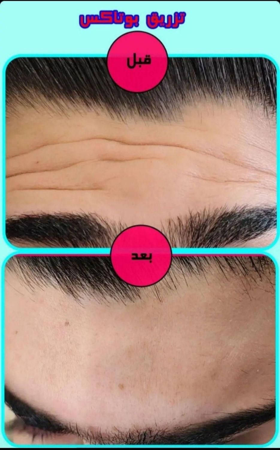 مرکز زیبایی دکتر تقوی|خدمات آرایشگری و زیبایی|یاسوج, |دیوار