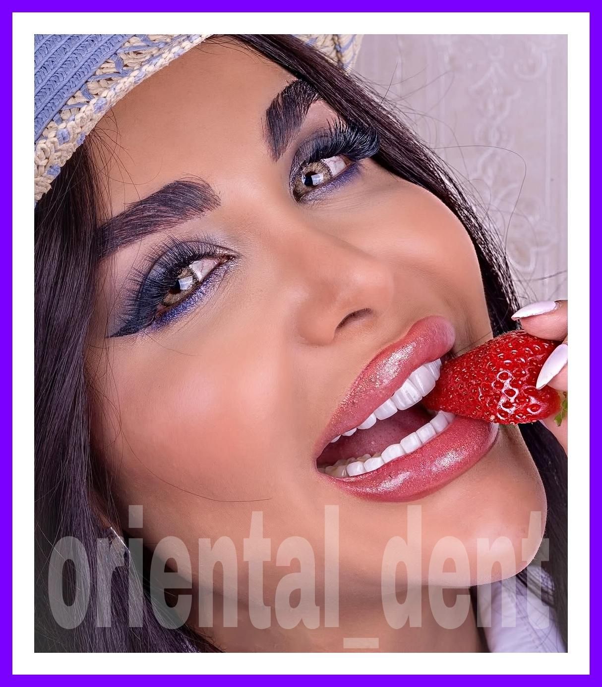 چک صیادی بلیچینگ ونیر جراحی دندان لیرینگ کامپوزیت|خدمات آرایشگری و زیبایی|تهران, تهران پارس|دیوار