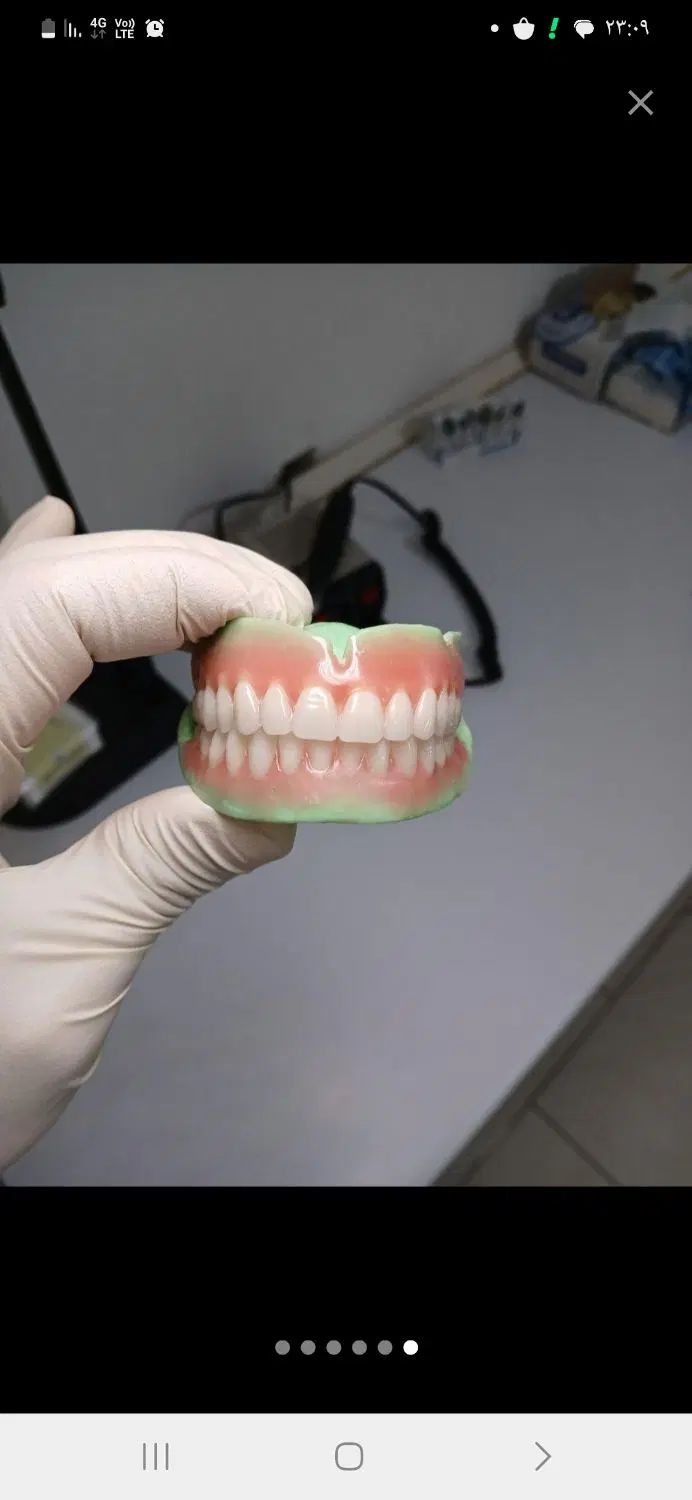 دندانسازی محمدی/طرح کامپوزیت|خدمات آرایشگری و زیبایی|محمدشهر, جعفرآباد|دیوار