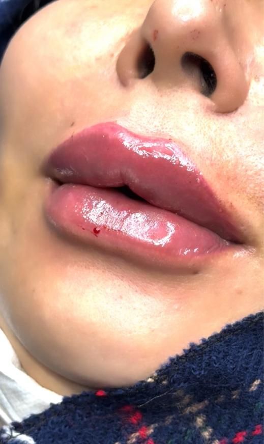 ژل و بوتاکس کلینیک زیبایی دکترفرشیدکریمی|خدمات آرایشگری و زیبایی|کرمانشاه, |دیوار