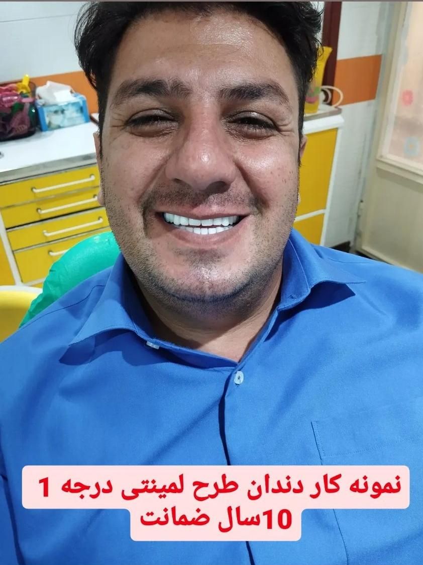 دندان مصنوعی خارجی8 سال ضمانت با بیمه دارای مجوز|خدمات آرایشگری و زیبایی|کرج, مصباح|دیوار
