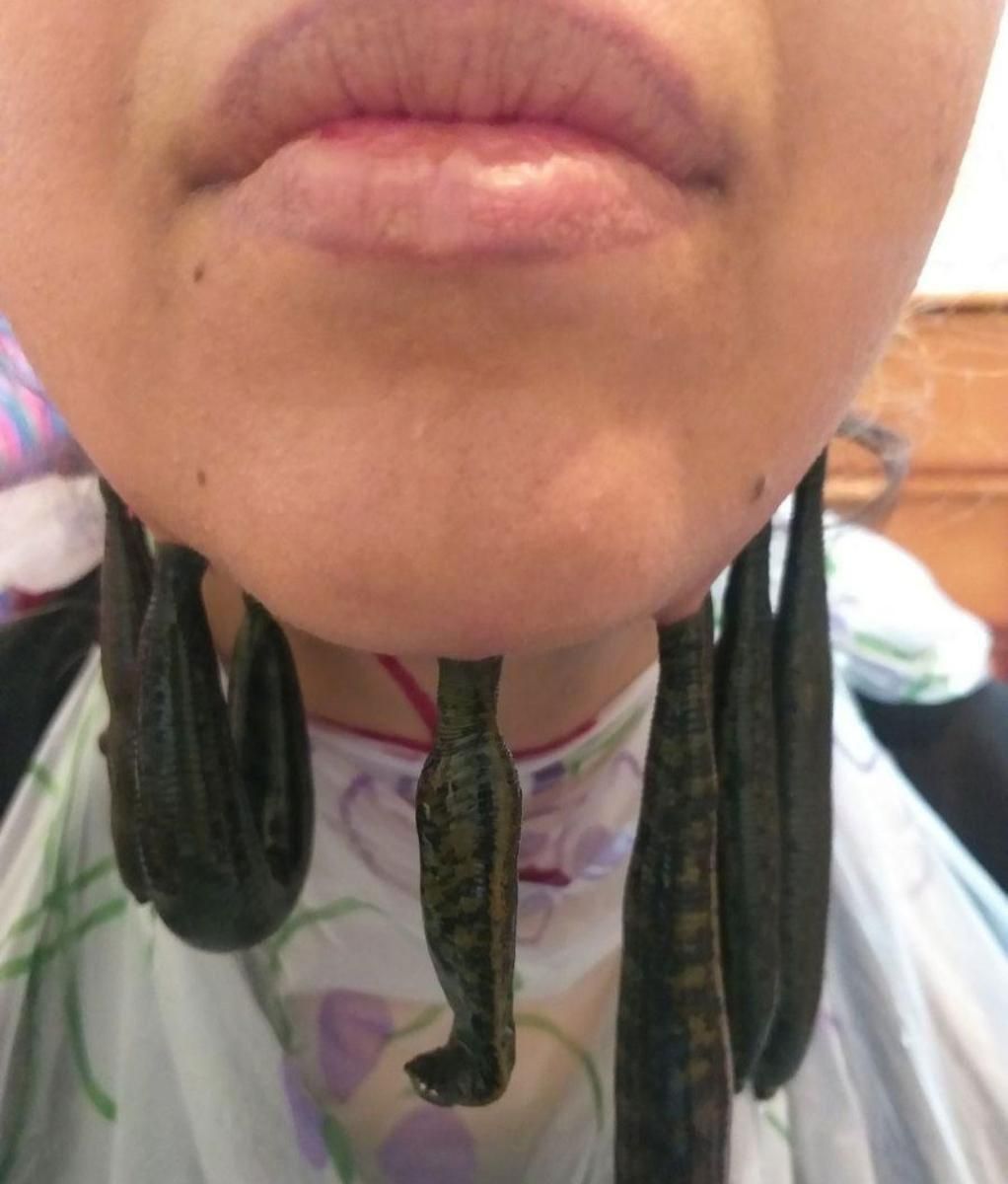 حجامت طب سنتی پی آر پی فیلر ژل سیاتیک فصد آموزش|خدمات آرایشگری و زیبایی|اصفهان, شفق|دیوار