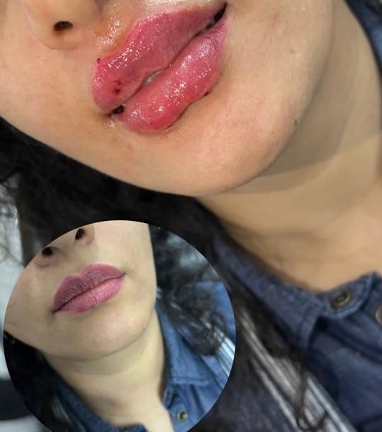 کلینیک تزریق ژل و بوتاکس انزیم پزشک|خدمات آرایشگری و زیبایی|کرج, گوهردشت|دیوار