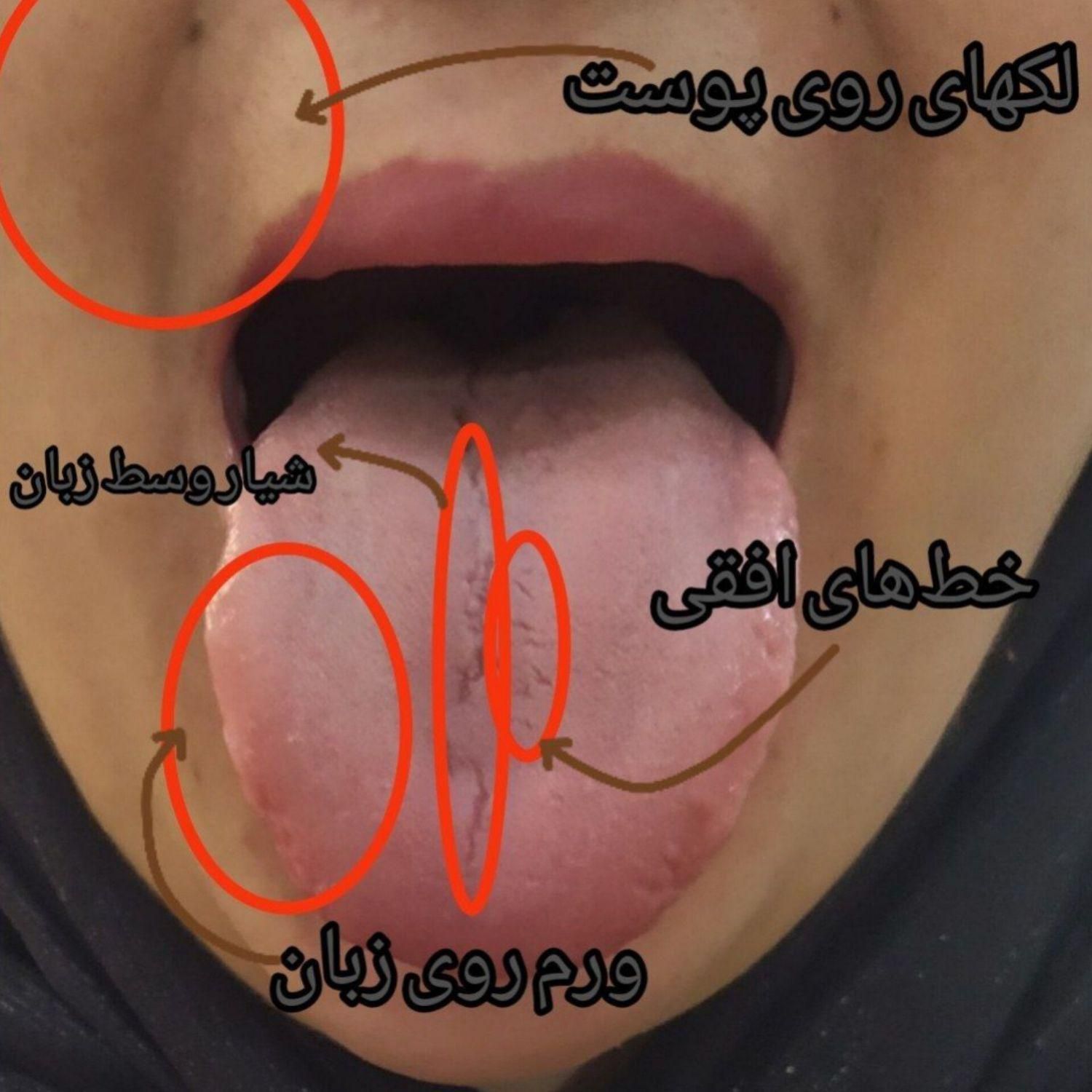 کاردرمنزل‌‌درزمینه‌طب‌سنتی‌‌باگوشی‌موبایل|استخدام درمانی، زیبایی، بهداشتی|مشهد, شهید بهشتی|دیوار