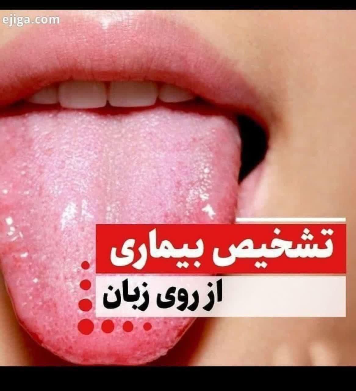 تشخیص بیماریها از روی زبان|خدمات آرایشگری و زیبایی|تهران, ایرانشهر|دیوار