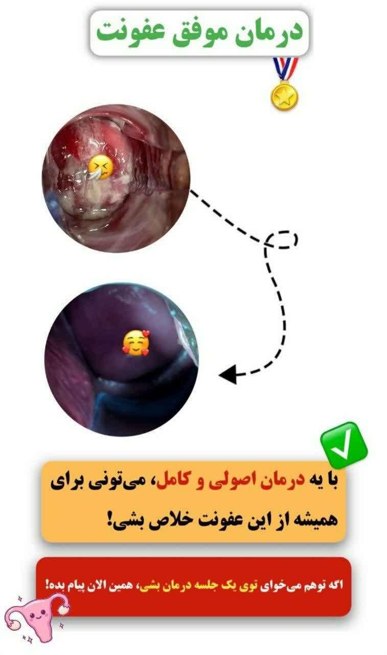 کلینیک ناباروری ، تنبلی تخمدان و پاکسازی رحم|خدمات آرایشگری و زیبایی|مشهد, بهشت|دیوار