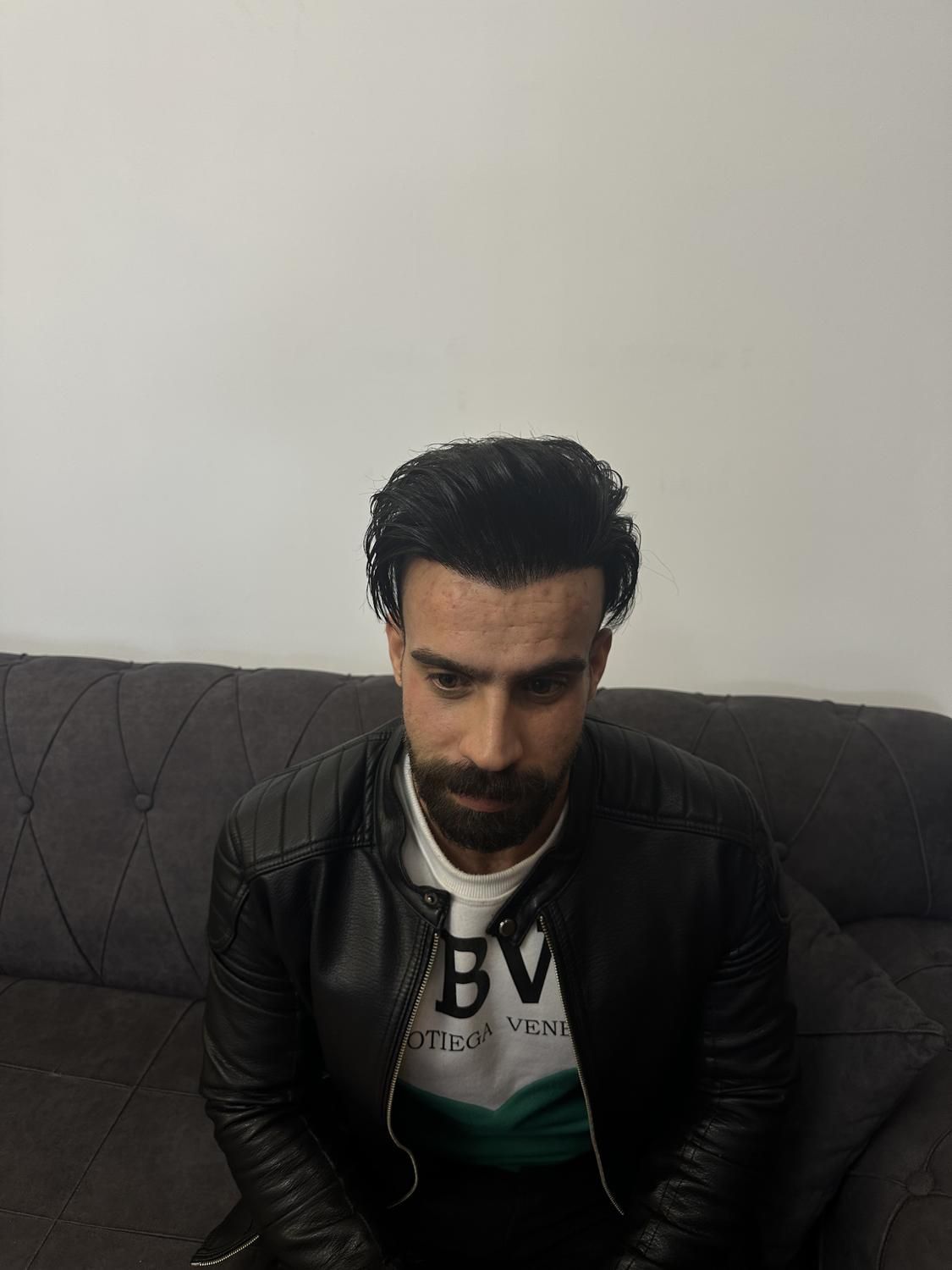 کاشت مو ابرو ریش کلینیک تخصصی اکسیر|خدمات آرایشگری و زیبایی|تبریز, |دیوار