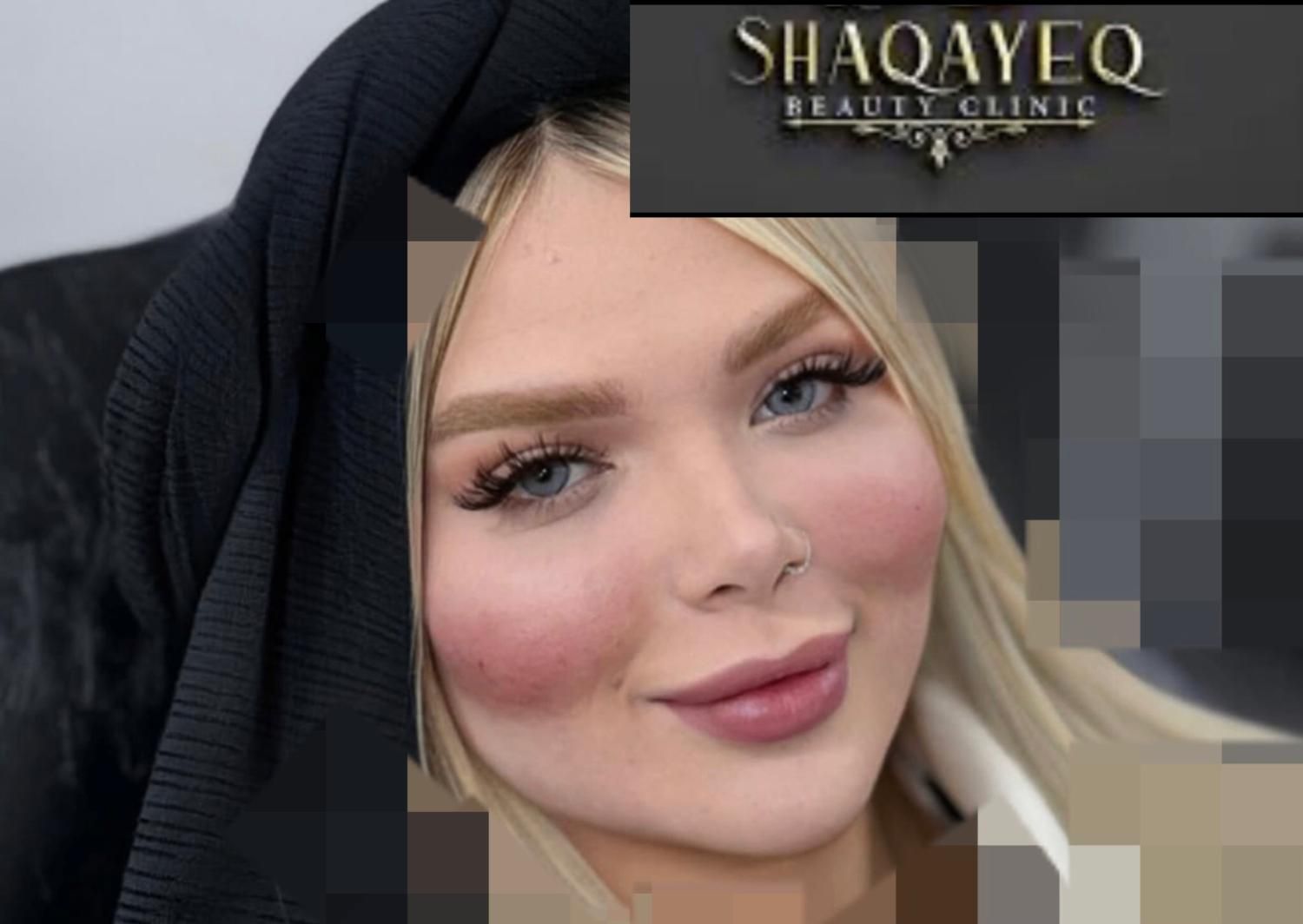 تزریق تخصصی ژل ومادلینگ وبوتاکس وهایفو|خدمات آرایشگری و زیبایی|کرمانشاه, |دیوار