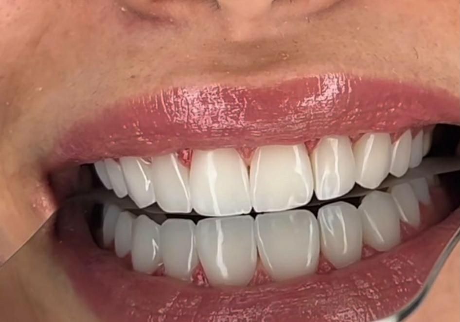 دندانپزشکی و دندانسازی پارسیان|خدمات آرایشگری و زیبایی|نسیمشهر, |دیوار