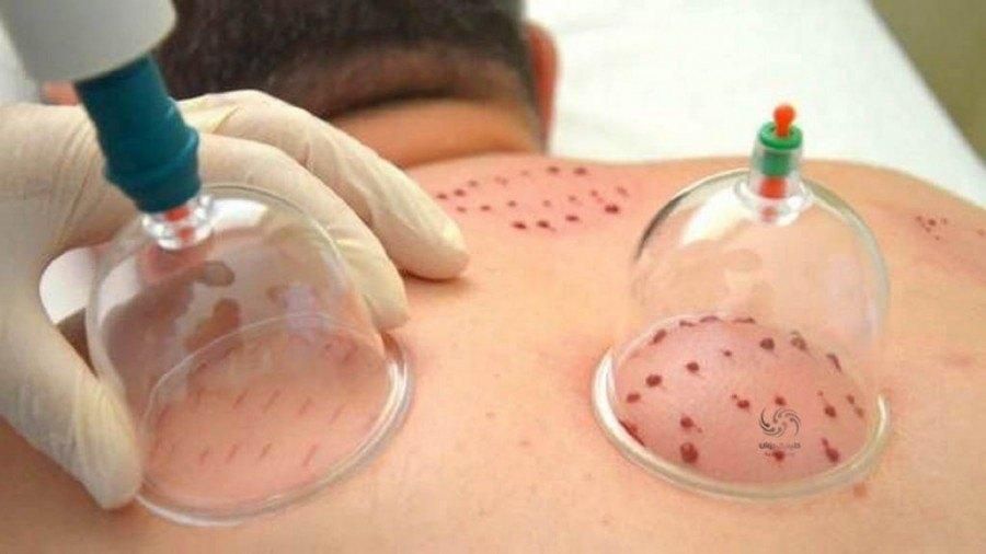تزریق سرم درمنزل،انواع تزریقات وحجامت درمنزل|خدمات آرایشگری و زیبایی|کاشان, سه راه پرورشگاه|دیوار