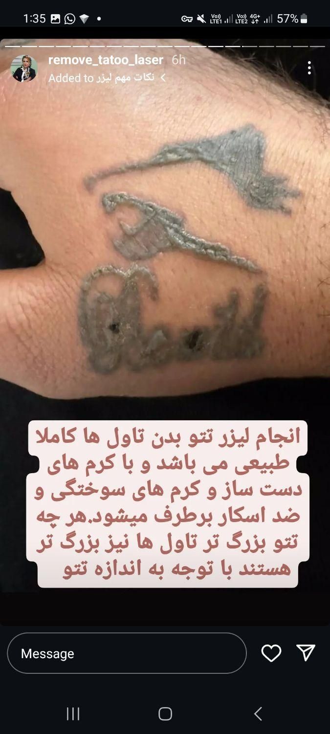 ریمو تتو و کربن تراپی|خدمات آرایشگری و زیبایی|سنندج, |دیوار