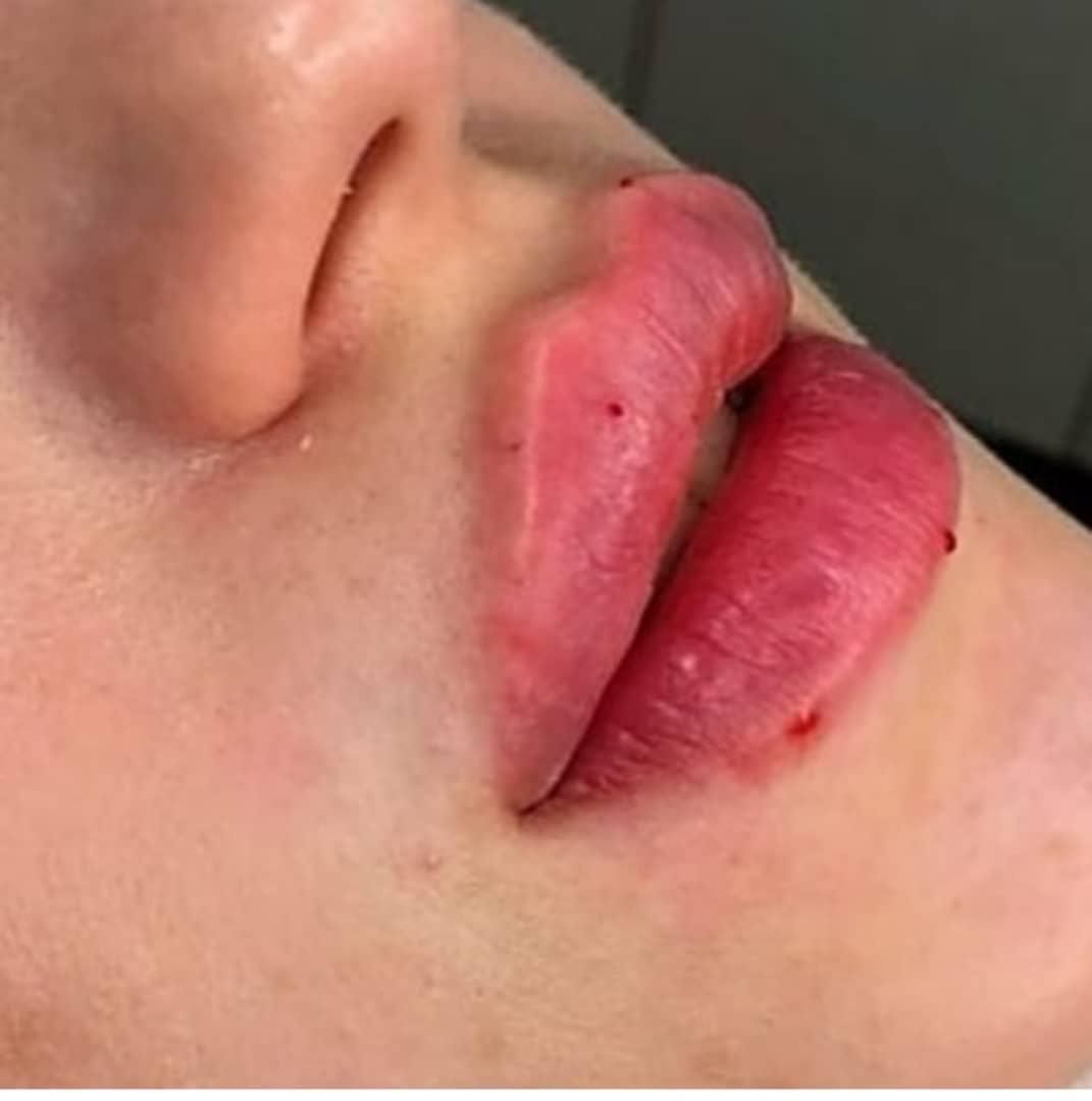تزریق ژل و بوتاکس در تمام ایام حتی روزهای تعطیل|خدمات آرایشگری و زیبایی|فردیس, |دیوار