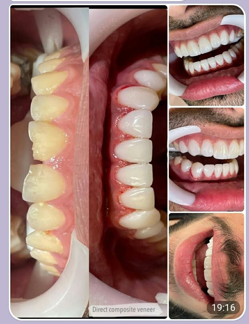 ارتودنسی توسط متخصص،دندانپزشکی اطفال،متخصص زیبایی|خدمات آرایشگری و زیبایی|اصفهان, هفتون|دیوار