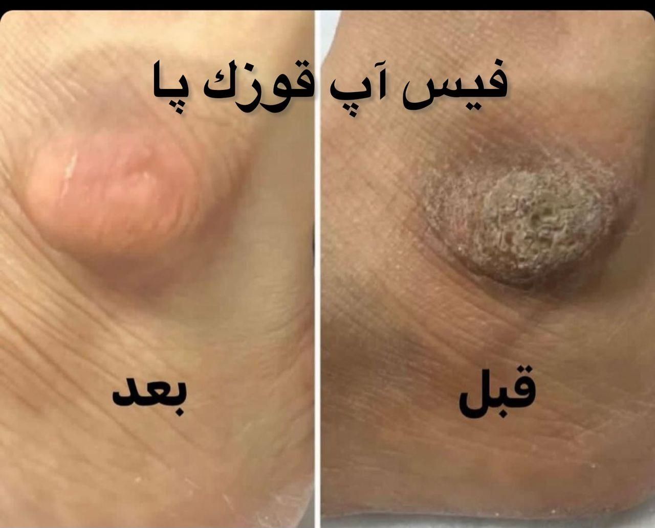رفع تیرگی بدن در مطب پزشکی با دستگاه|خدمات آرایشگری و زیبایی|شیراز, قدوسی غربی|دیوار