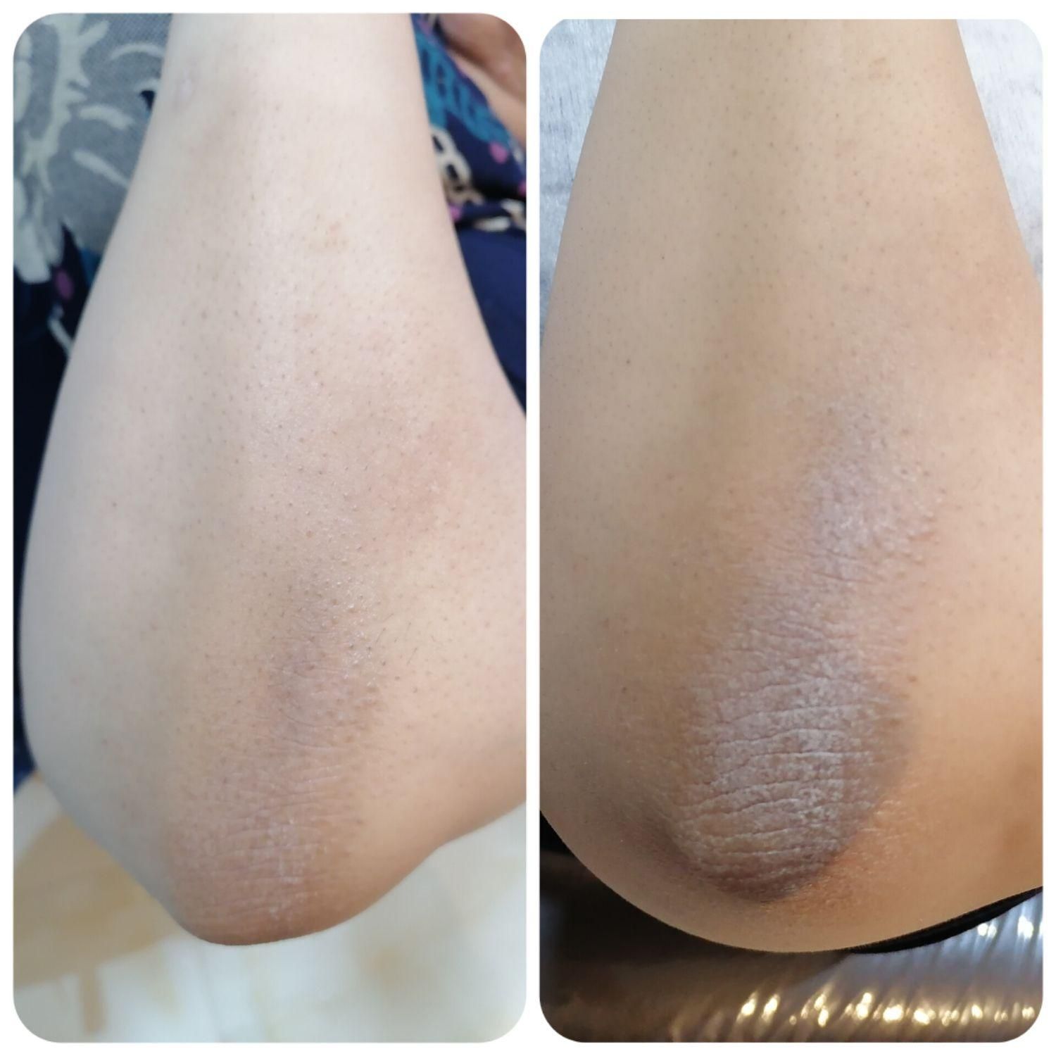 پاکسازی و فیشال تخصصی|خدمات آرایشگری و زیبایی|شاهین‌شهر, فردوسی|دیوار