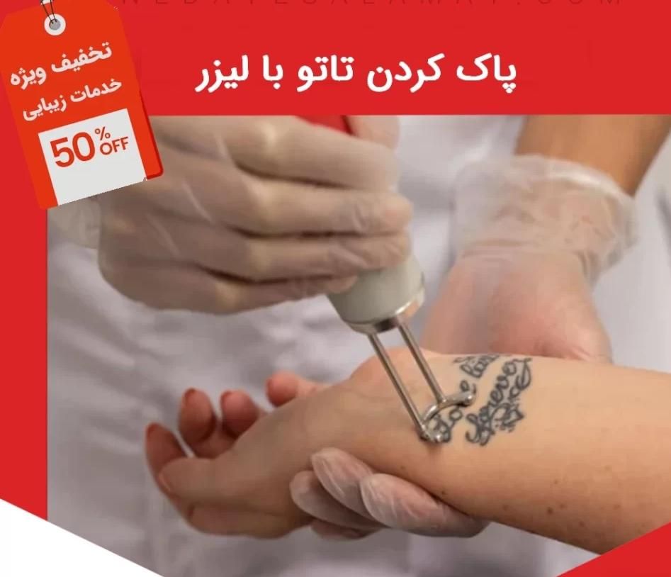 ریمو تتو.جوانسازی پوست. کربن تراپی. کربکسی تراپی|خدمات آرایشگری و زیبایی|کرمانشاه, |دیوار