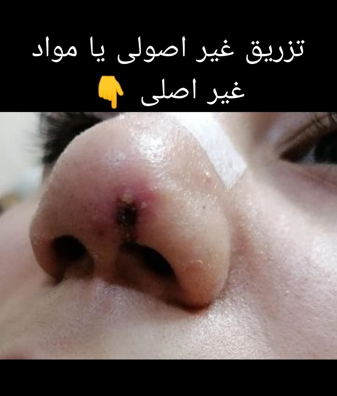 کلینیک ژل آنزیم بینی. لب بوتاکس فیلر و آموزش|خدمات آرایشگری و زیبایی|مشهد, آزادشهر|دیوار