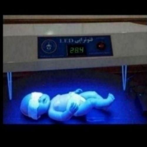 اجاره دستگاه فتوتراپی ( زردی نوزاد ) در منزل|خدمات آرایشگری و زیبایی|گرگان, |دیوار