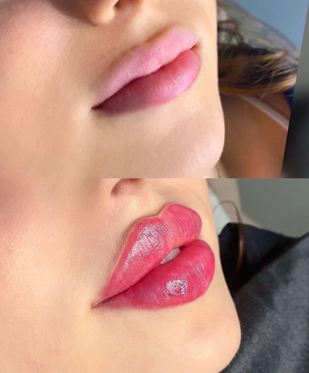 فیلر،ژل بوتاکس،آنزیم،فیلر بادی،پیرسینگ|خدمات آرایشگری و زیبایی|شیراز, میرزاکوچک خان|دیوار