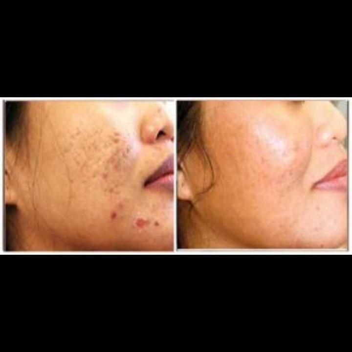 تخصصی پی آر پیprpحرفه ای بوتاکس ژل حجامت70فیلر فصد|خدمات آرایشگری و زیبایی|اصفهان, وحید|دیوار